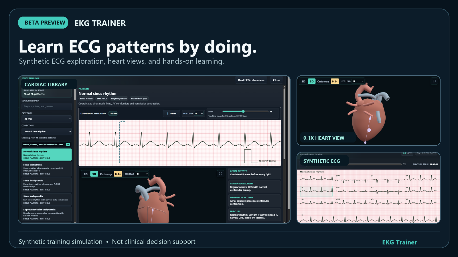Edited composition of EKG Trainer app screens: a normal-rhythm Library view, slow-motion heart view, and synthetic twelve-lead readout