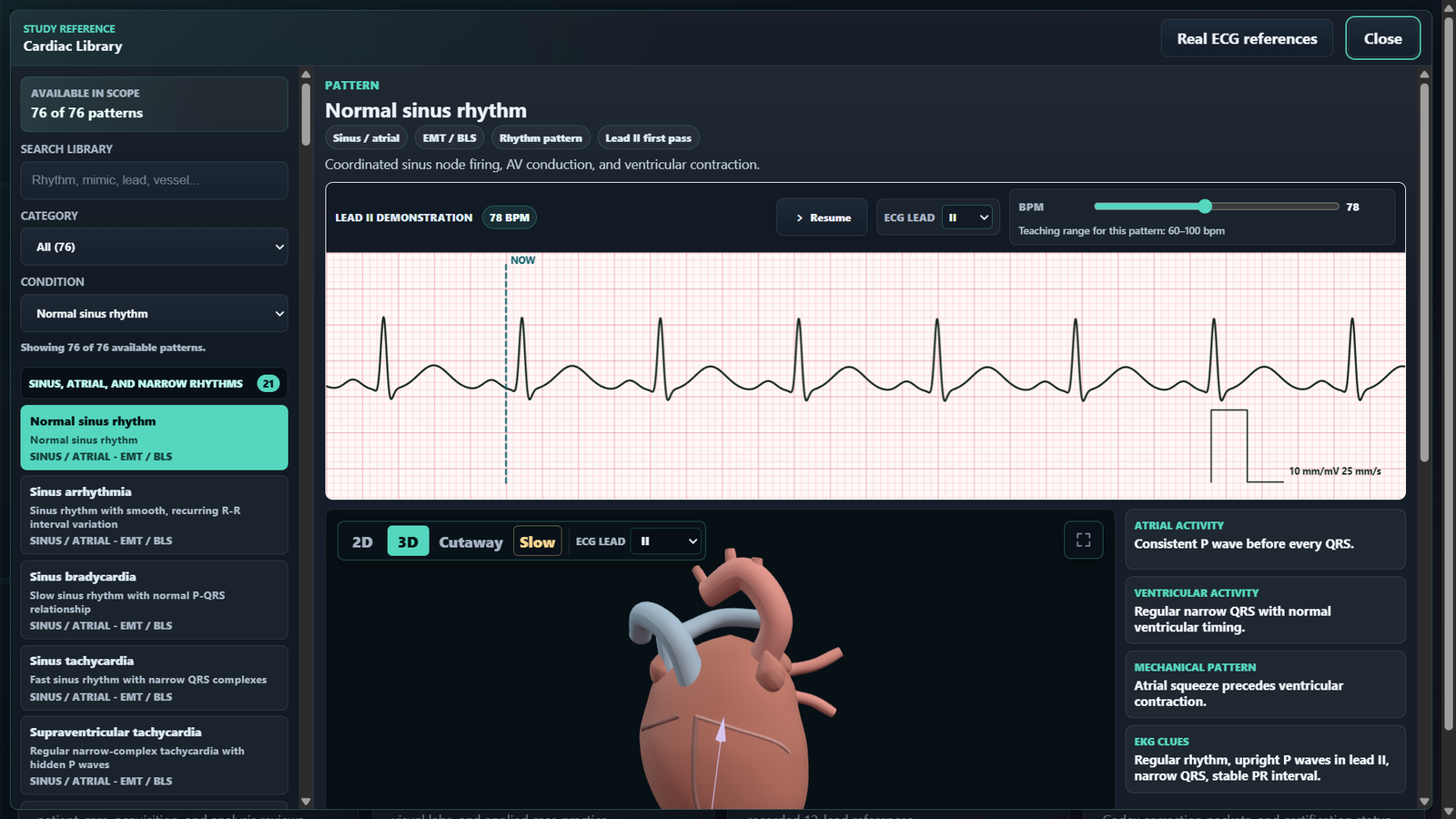 Cardiac Library showing a selected synthetic normal-rhythm example, ECG strip, and heart view