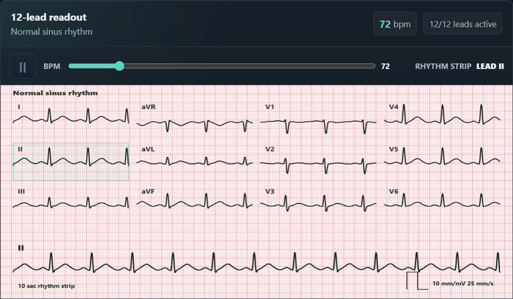EKG Trainer Skills readout with twelve active synthetic leads and a rhythm strip