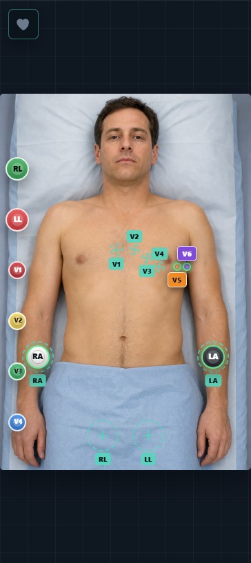 EKG Trainer mobile placement view showing separate V5 and V6 controls on an adult patient illustration
